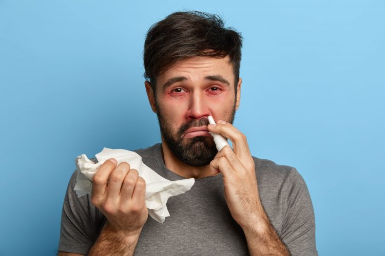 Hypersensive European man suffers from allergy, has red swelling eyes, inflammation of nose. Sick ma