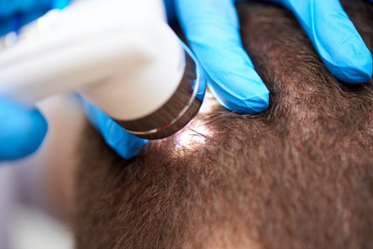 Medical examination of the hair and scalp