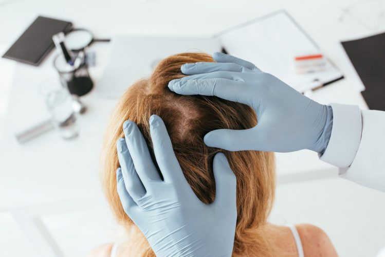 overhead view of dermatologist in blue latex gloves examining hair of patient in clinic