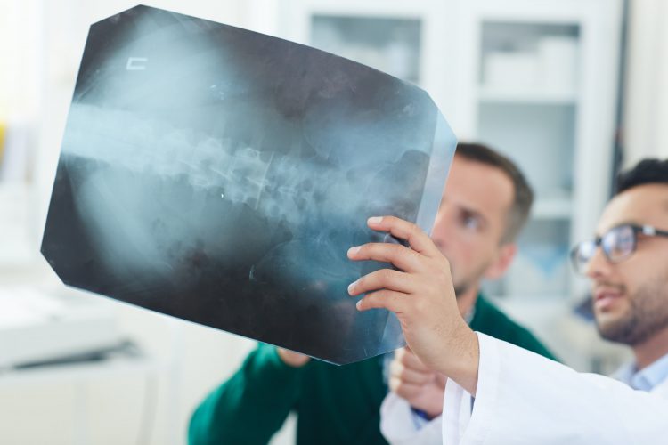 Spinal x-ray