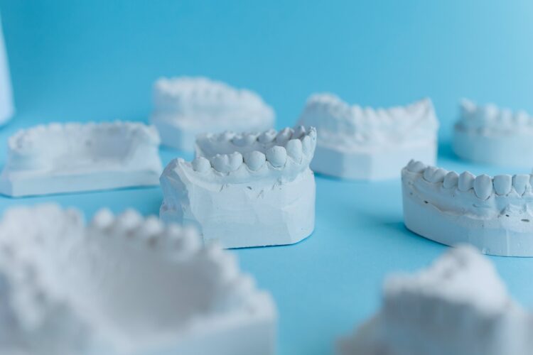 Many plaster models of teeth on a blue background