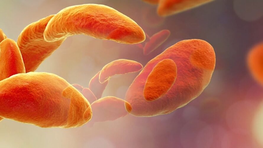 parasite-in-your-brain