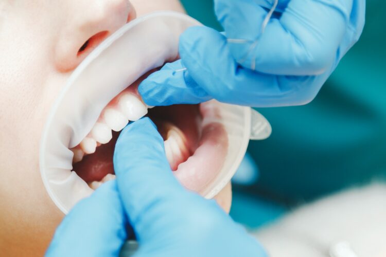 Close up of female mouth with retractor. Doctor flossing the teeth
