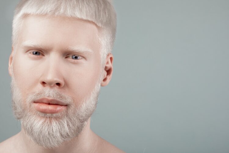 Portrait of albino bearded man with white hair and pale skin looking at camera, grey background with