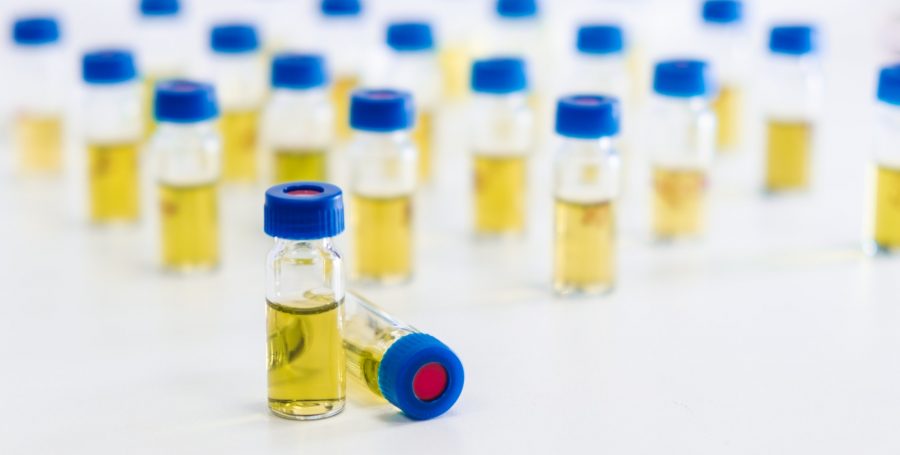 Test tubes with urine sample for HPLC analysis in the laboratory