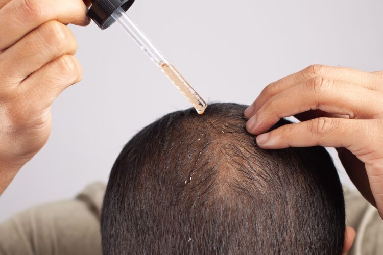 essential hair oil treatment for androgenetic alopecia hair loss